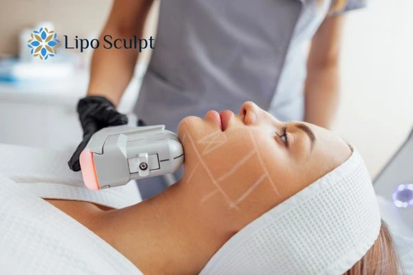 HIFU vs Botulinum Toxin: Understanding the Differences 1 HIFU vs Botox Hythe What is the best option for you?