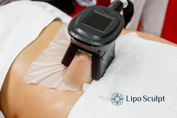 Does Fat Freezing at Home Work? DIY Devices vs Professional Cryolipolysis 1 How is professional cryolipolysis different Hythe?