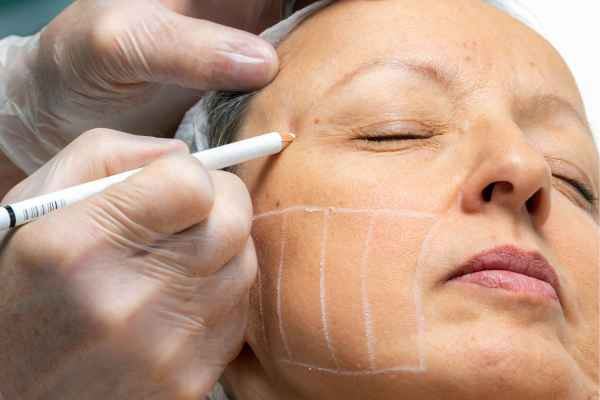 CryoPen: 5 Skin Concerns It May Be Used to Treat 4 What should you ask before having CryoPen treatment Hythe?