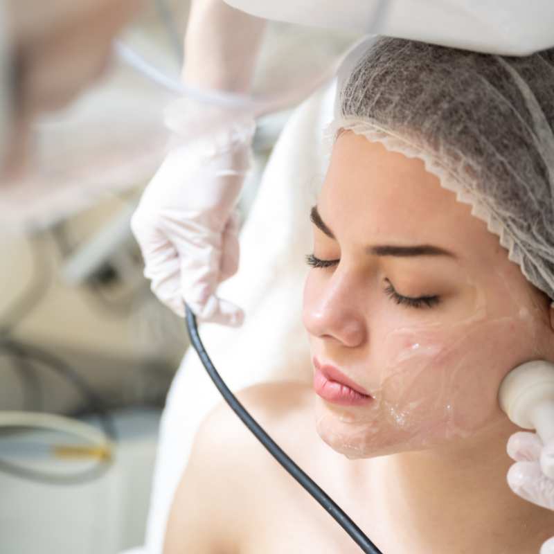 Why Do People Choose HIFU for a Non-Surgical Facelift? 5 What are the risks Hythe?