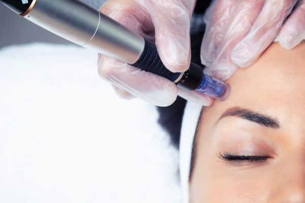 Explaining Total Skin Tightening Treatment and What to Expect 2 What Skin Concerns Can Total Skin Tightening Treatment Help With Hythe?